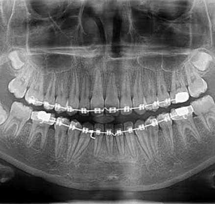 Radiografia Panorâmica