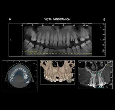 Tomografias